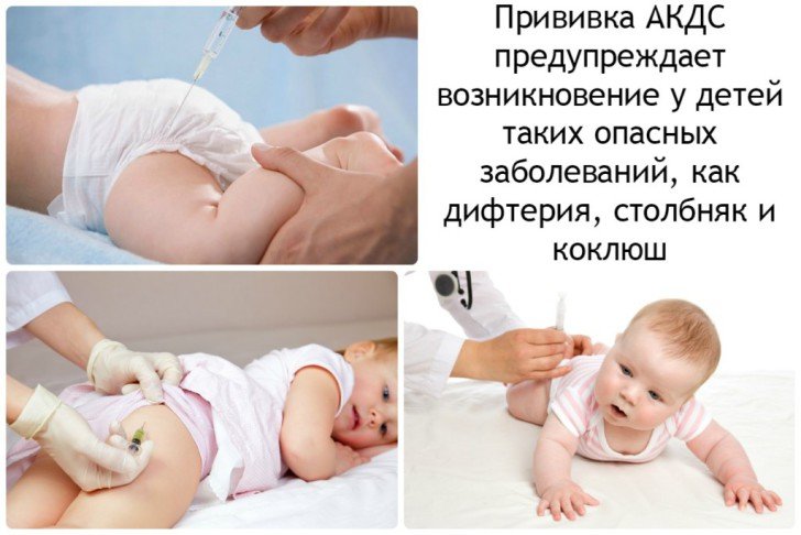 Наслідки після виконання щеплення АКДП у дітей: реакція на вакцинацію, побічні ефекти і ускладнення у грудничка
