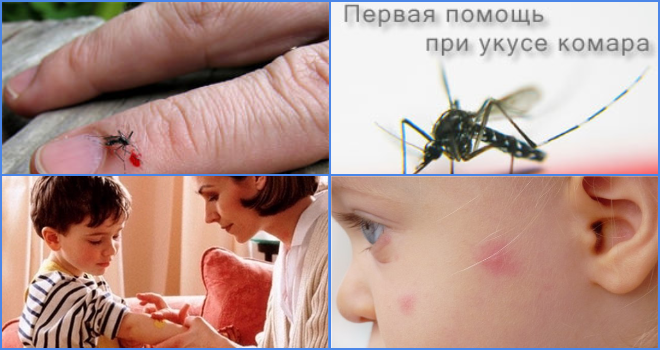 Чому варто помазати укуси комарів дитині?