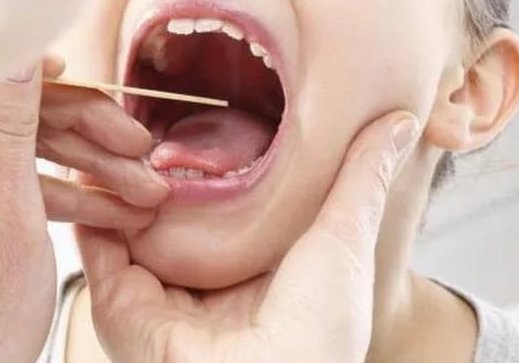 Як позбавитися від запаху цибулі з рота Як терміново прибрати запах цибулі з рота