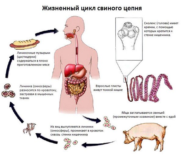 Лікування кишечника від паразитів, їх види та вплив