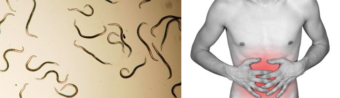 Глисти і паразити в животі людини — симптоми і лікування