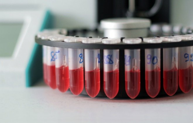 Про що свідчить зниження тромбоцитів у крові дорослої людини?