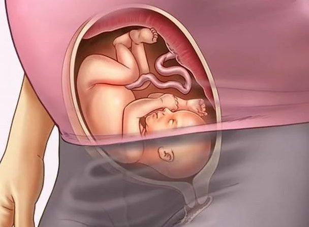 Гикавка при вагітності Ікання на ранніх термінах під час вагітності