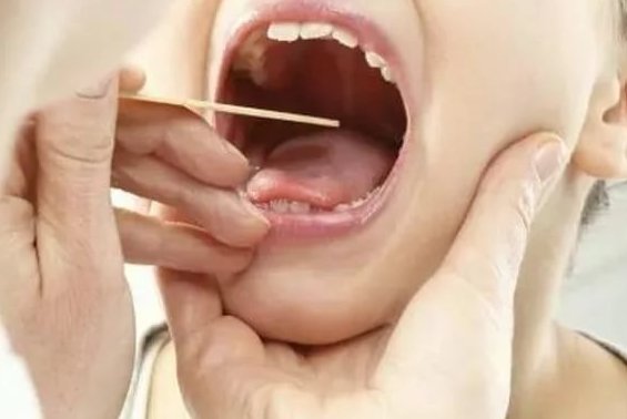 Печінковий запах з рота: причини появи