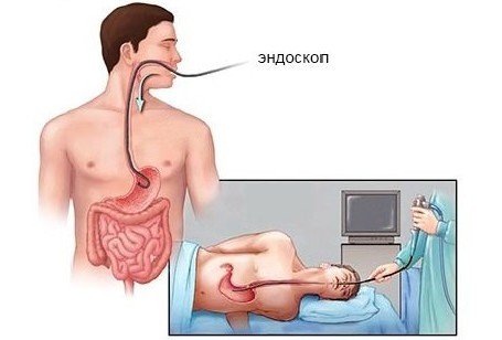 Діагностика захворювань кишечника і прямої кишки