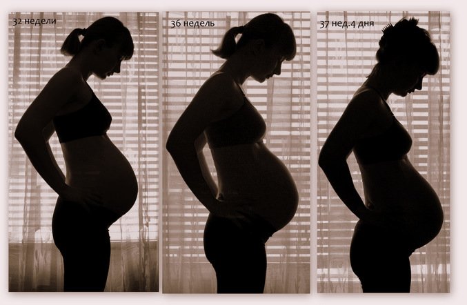 Опустився живіт при вагітності і хвороби: як зрозуміти та що робити