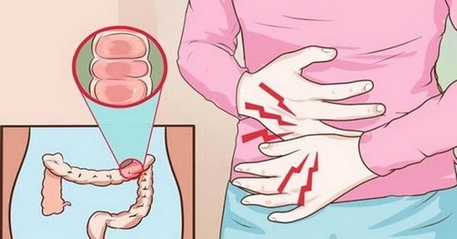 Лікування ішемії кишечника, її причини, симптоми та діагностика