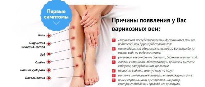 Профілактика варикозу вен на ногах: особливості рекомендацій