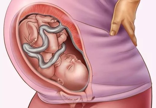 Гикавка у плода під час вагітності Чому плід гикає при вагітності