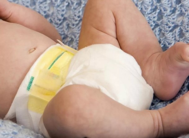 Запор у новонародженого малюка при грудному вигодовуванні Запори у новонароджених на ГВ: причини запору у немовлят