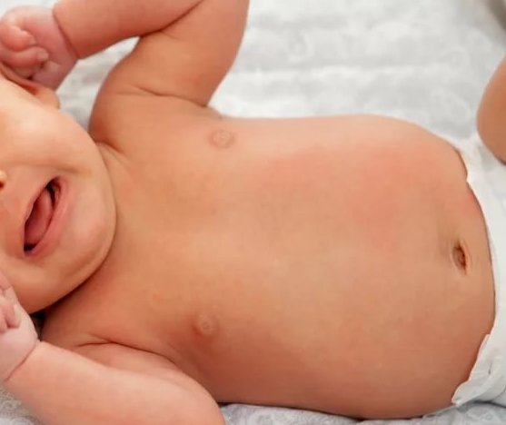 Продукти викликають кольки в немовлят Які продукти викликають у немовлят при грудному вигодовуванні