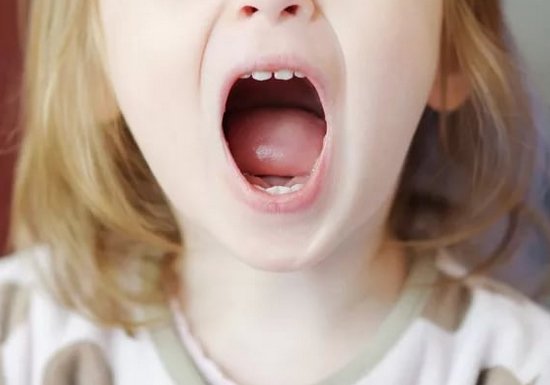 Неприємний запах з рота у дитини і дітей: причини Чому поганий