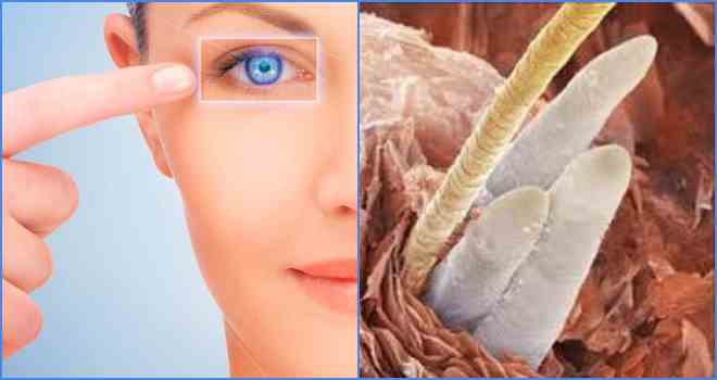 Симптоми і лікування очного кліща