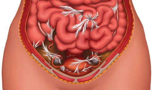 Можливі захворювання кишечника — їх причини і симптоми