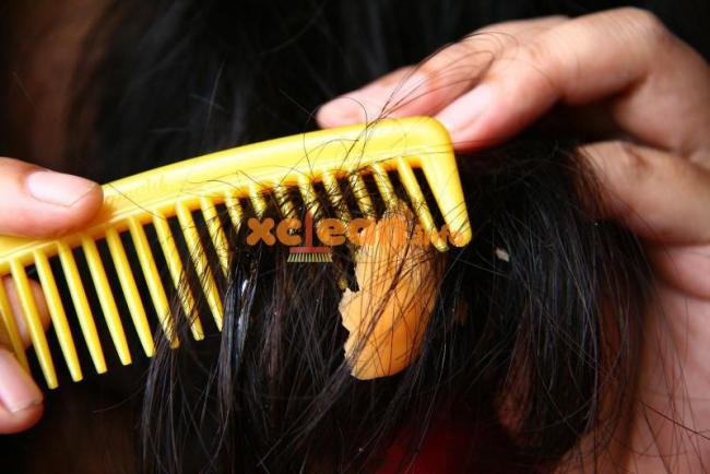 Як просто і швидко прибрати жуйку з коренів і кінчиків волосся? – народні методи
