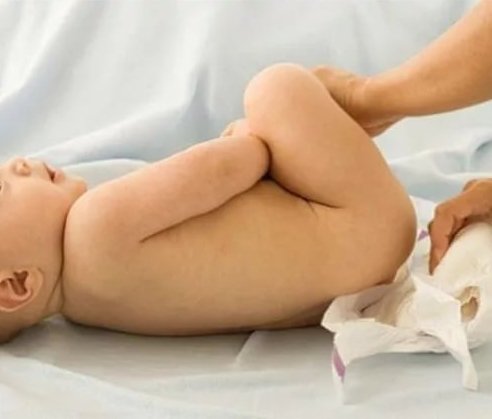 Пронос у новонародженого немовляти при штучному вигодовуванні