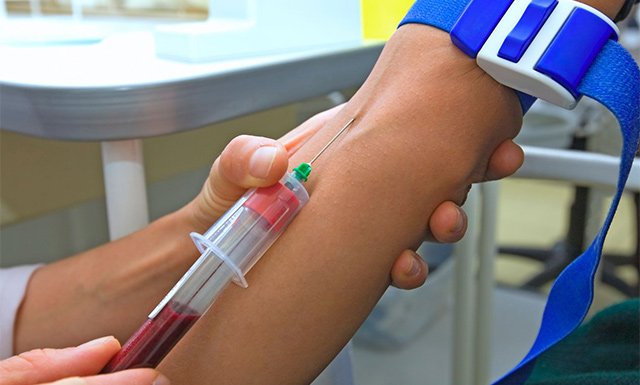 Підготовка і розшифровка аналізу крові на холестерин