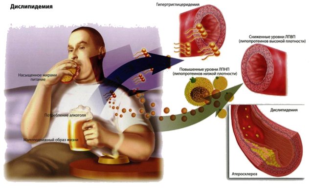 Особливості харчування при підвищеному холестерин в крові у чоловіків