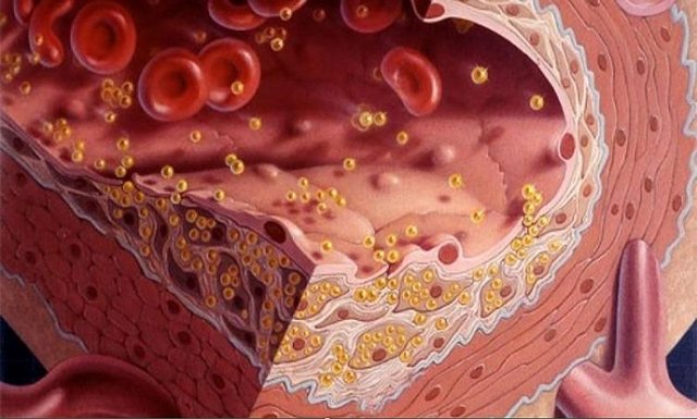 Причини низького вмісту холестерину в крові у чоловіків та жінок