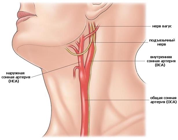 Сонна артерія: її характеристика та можливі захворювання