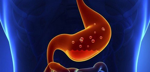 Лікування підвищеної кислотності шлунка, її причини і симптоми
