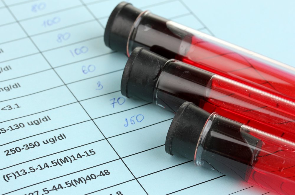 Норма гемоглобіну у чоловіків – аналіз рівня в крові
