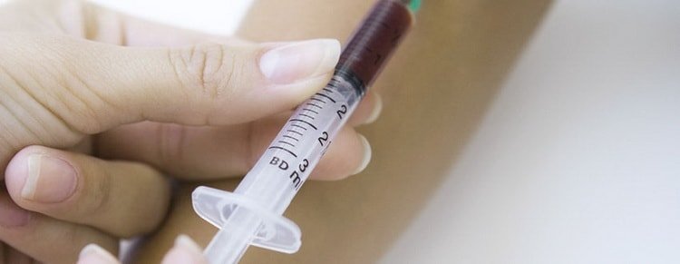 Аналіз крові на вагітність: коли здавати, розшифровка