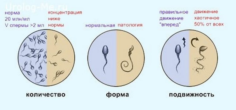 Як поліпшити спермограму при плануванні вагітності
