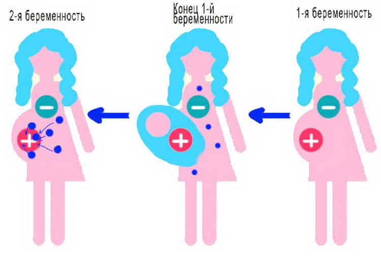 Конфлікт резус факторів крові при вагітності
