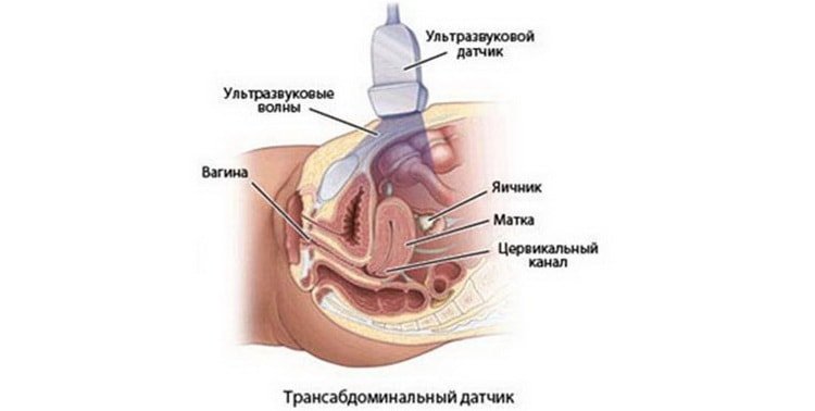 На якому терміні УЗД показує вагітність