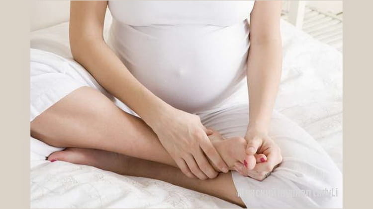 Набряки при вагітності: що робити
