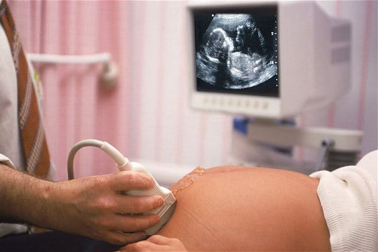 Третій скринінг при вагітності — терміни проведення, норми