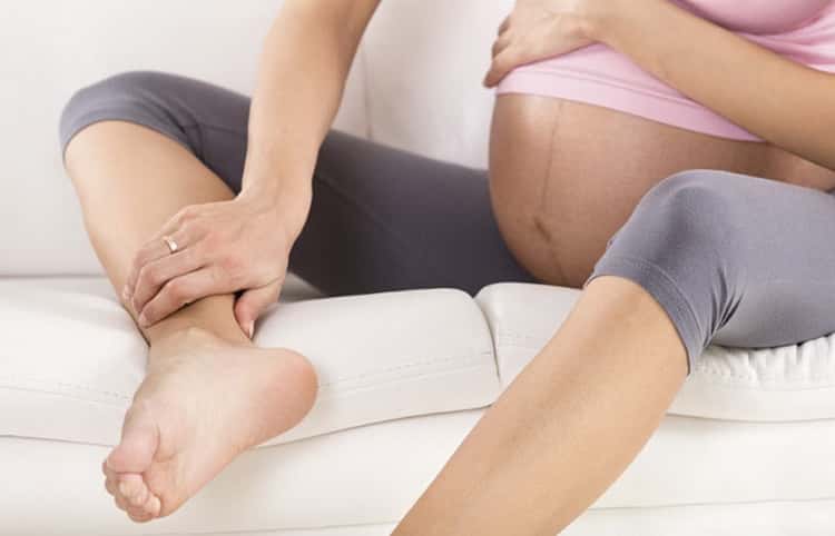 Варикоз під час вагітності: причини і наслідки