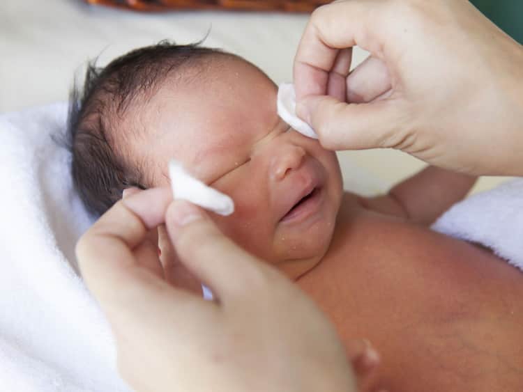 Чим лікувати конюнктивіт у новонародженої дитини