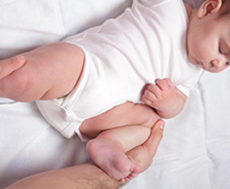 Дисплазия сустава у новорожденного лечение. Дисплазия у новорожденных. Дисплазия тазобедренных суставов у новорожденных.