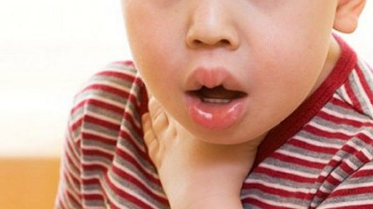 Харчова алергія у дітей: симптоми, лікування
