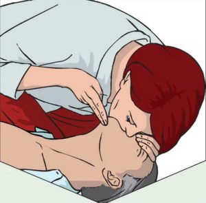 Штучна вентиляція легенів (ШВЛ) і непрямий масаж серця