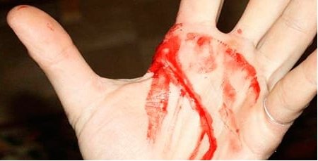 Як зупинити кров при порізі пальця і не допустити інфікування рани