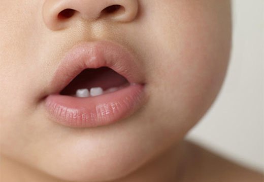 Може бути пронос при прорізуванні зубів у дітей і скільки він триває
