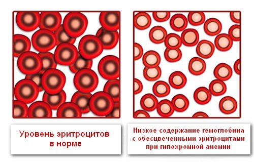 Норми загального аналізу крові у дітей розшифровка + ТАБЛИЦІ