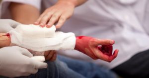 Перша допомога при артеріальній кровотечі тактика дій в домашніх умовах