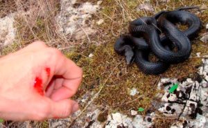 Перша допомога при укусі змії: як залишитися живим