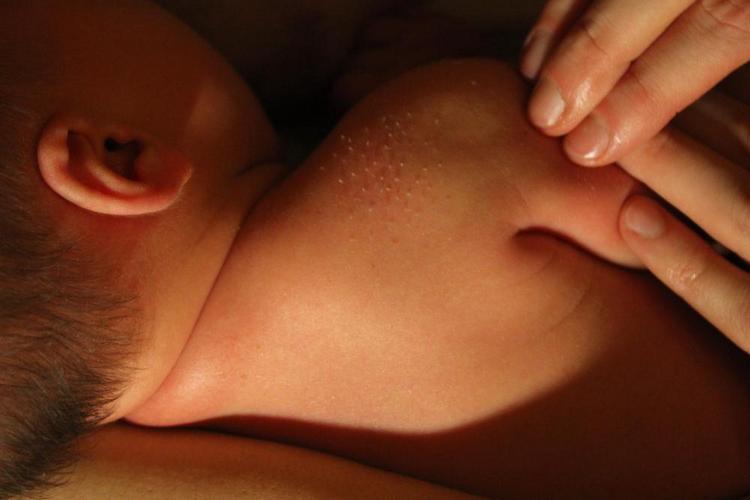 Щетинка у новонароджених: як визначити і вивести