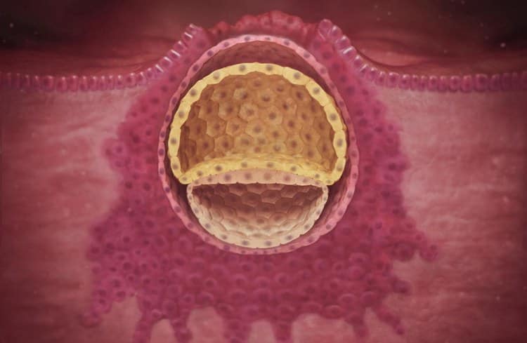 Імплантація ембріона – що це і коли її чекати