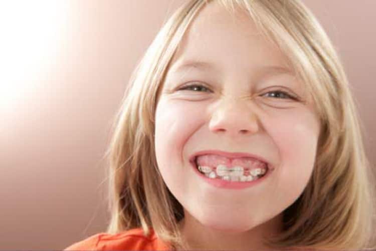 Пластини для зубів для дітей