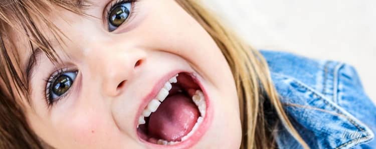 Чому криві зуби у дітей: молочні і корінні, фото