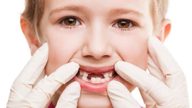 Схема випадання молочних зубів у дітей