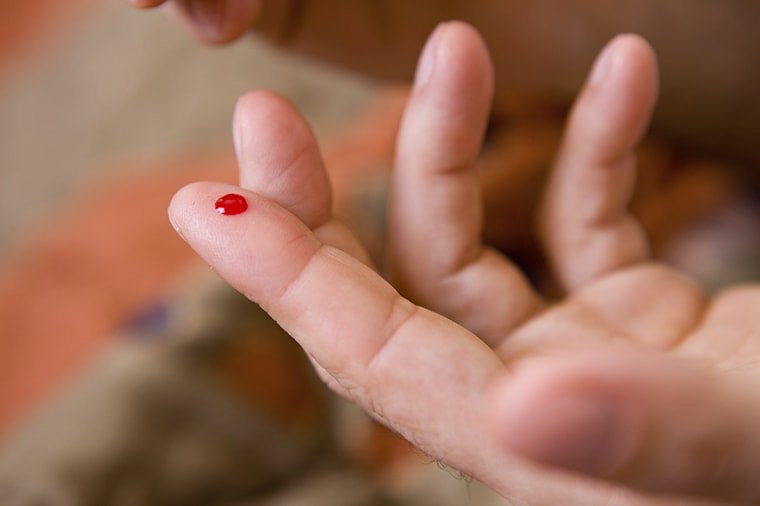 Боязнь крові: як називається фобія і як перестати боятися?