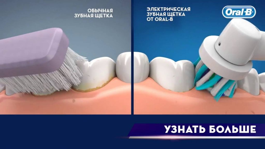 Як вибрати електричну зубну щітку – стоматологів відгуки