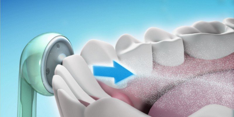 Як вибрати іригатор для порожнини рота – стоматологів відгуки